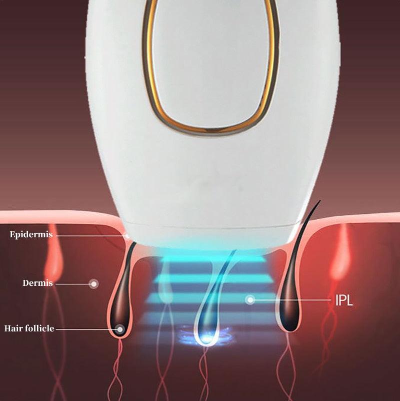 Depilador a Laser Definitivo Importado/LaserDepil - LOJA DO FROIFO